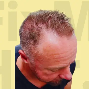 Patient before treatment